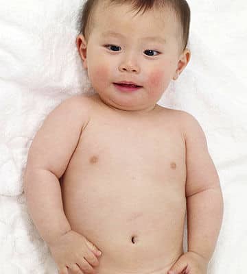 Food Allergies in Babies