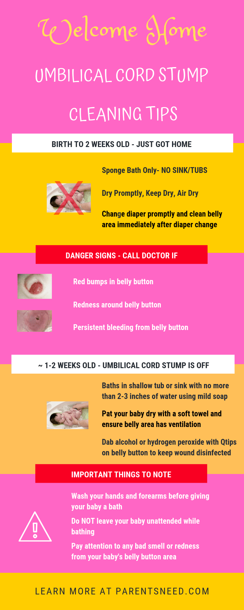 infographic tips to care for baby's umbilical cord stump after it comes off