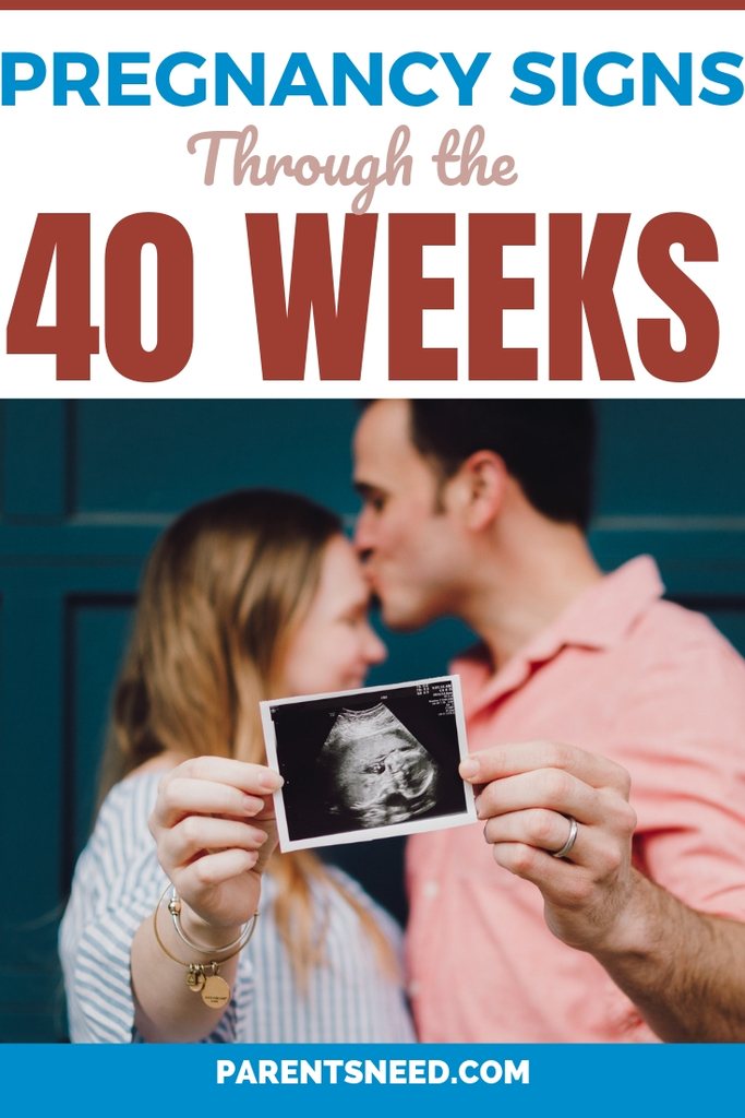 Parents holding an ultrasound image of their unborn baby