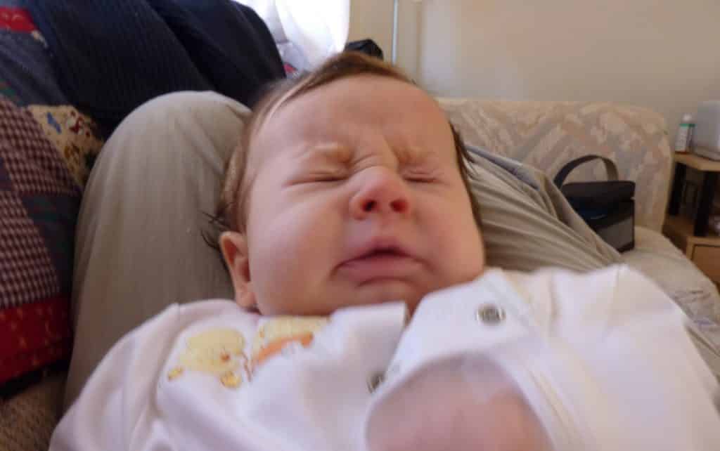 Unusual Baby Features You May Encounter in New Born Babies