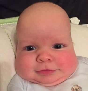 Unusual Baby Features You May Encounter in New Born Babies